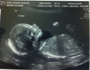 Baby H #2 at 18 weeks. 